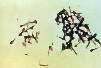 破傷風菌の電子顕微鏡写真